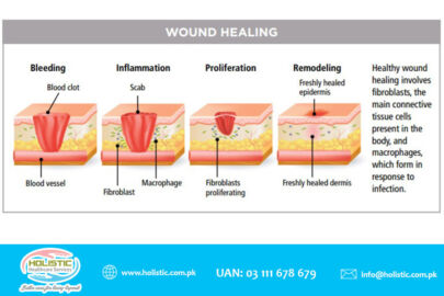 wounds healing