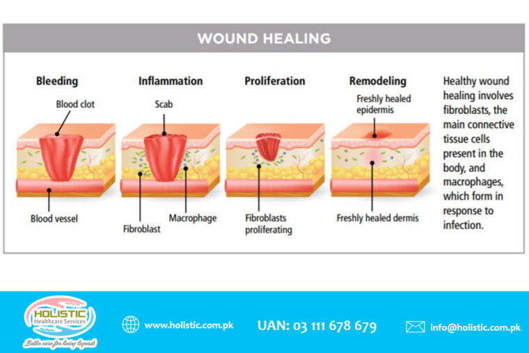 Wounds Healing Tips for Caregivers and Nurses - Call at 03 111 678 679